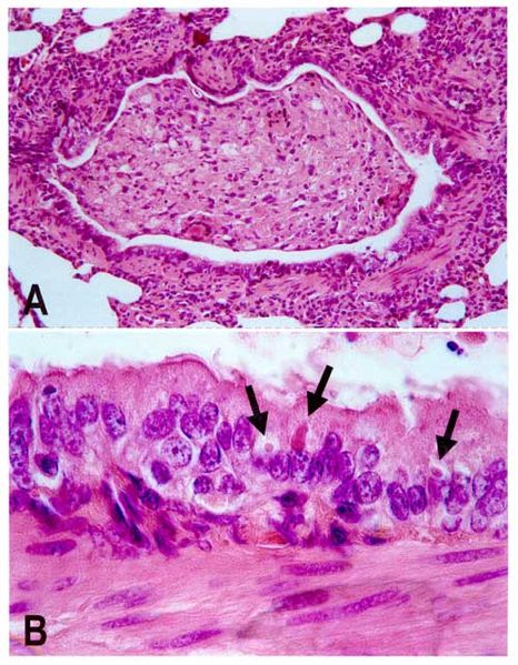 Lung lesions in a dog with distemper